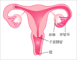 子宮内膜症って何？